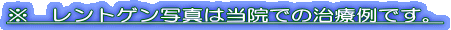 ※　レントゲン写真は当院での治療例です。 