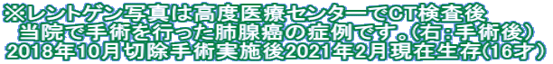 ※レントゲン写真は高度医療センターでCT検査後　　　　 当院で手術を行った肺腺癌の症例です。(右：手術後） 2018年10月切除手術実施後2021年2月現在生存(16才）